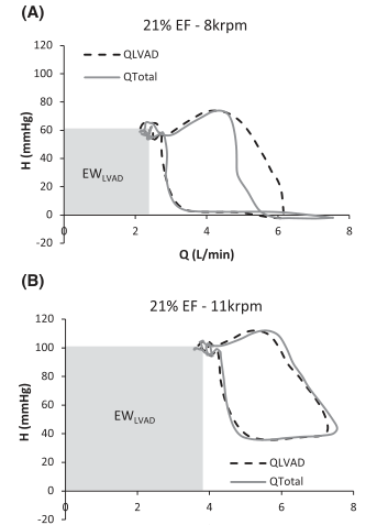 Published dynamic pressure-flow H-Q loops comparing partial and full LVAD bypass