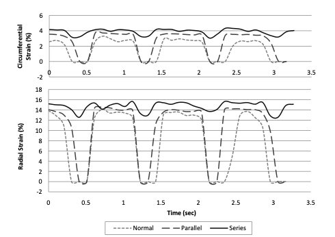 Circumferential and radial aortic valve strains versus time for normal, parallel, and series flow configurations